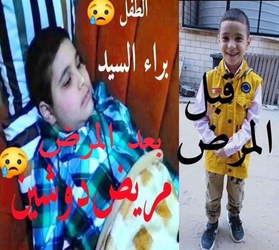 الاتحاد قوة.. أبناء كفر الشيخ يتجمعون لمساندة الطفل براء في علاج مرض “الدوشين”